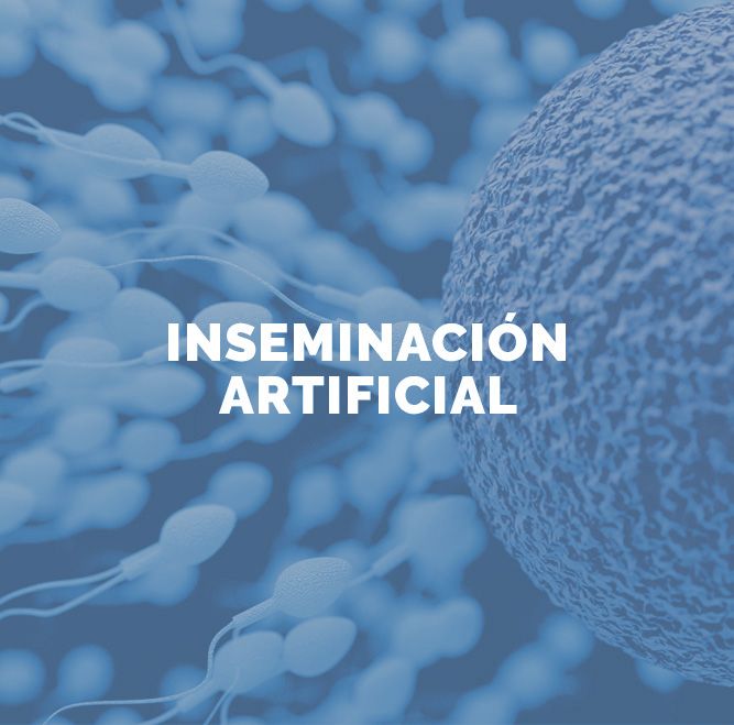 Inseminación Artificial