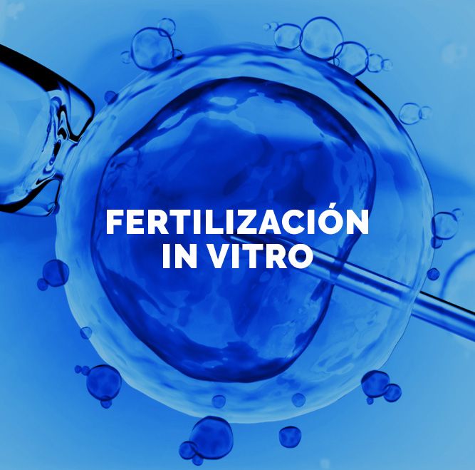 Fertilización in Vitro