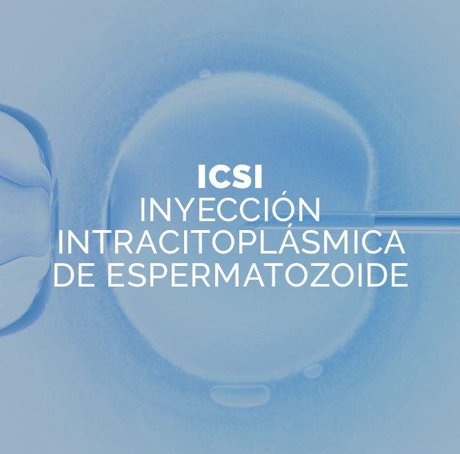 Fertilización por ICSI
