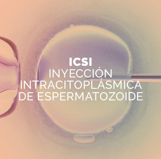 Fertilización por ICSI