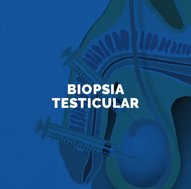 Biopsia testicular