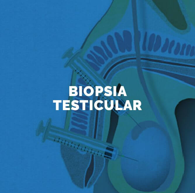 Biopsia testicular