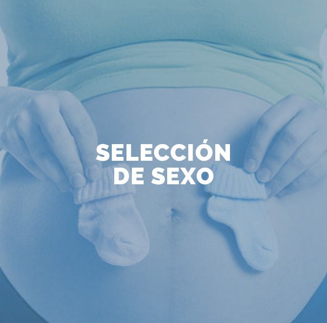 Selección del sexo
